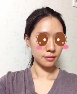 大鼻子实在让人讨厌,曾经还没男同学取名叫做大鼻怪.