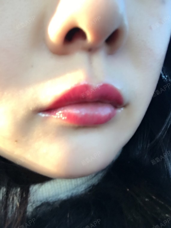 下唇掉色有点严重