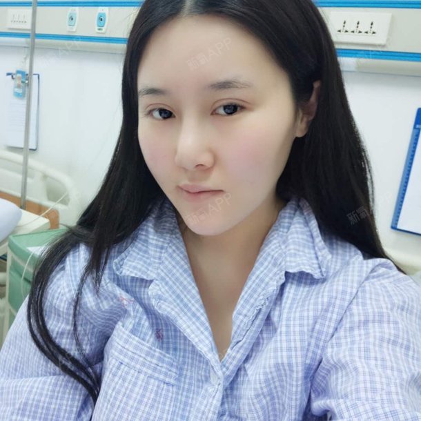 北京亚馨美莱坞医疗美容颧骨降低怎么样?