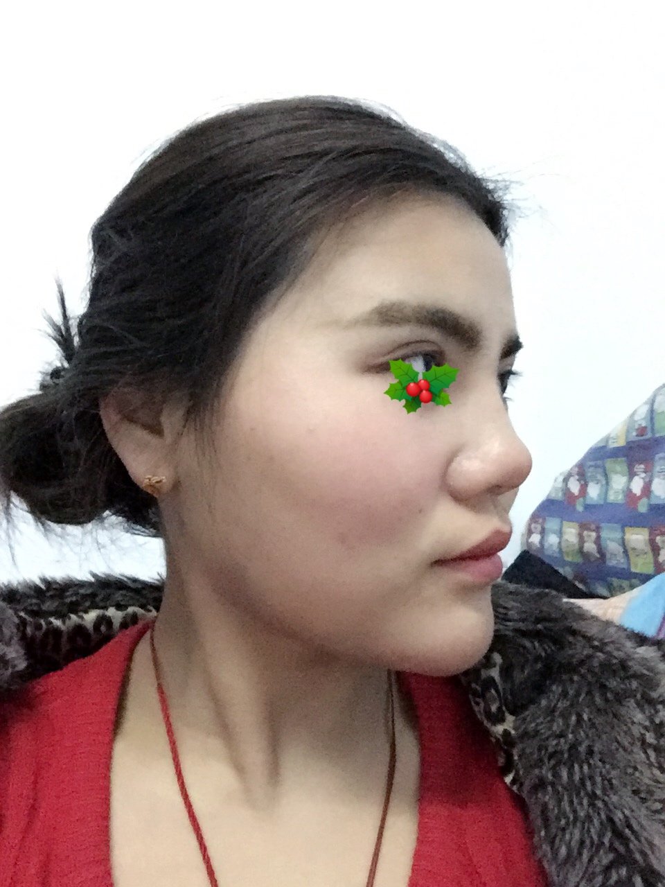 新氧- 慧_397883 | 精选问答 | v型脸 | 洛阳同城