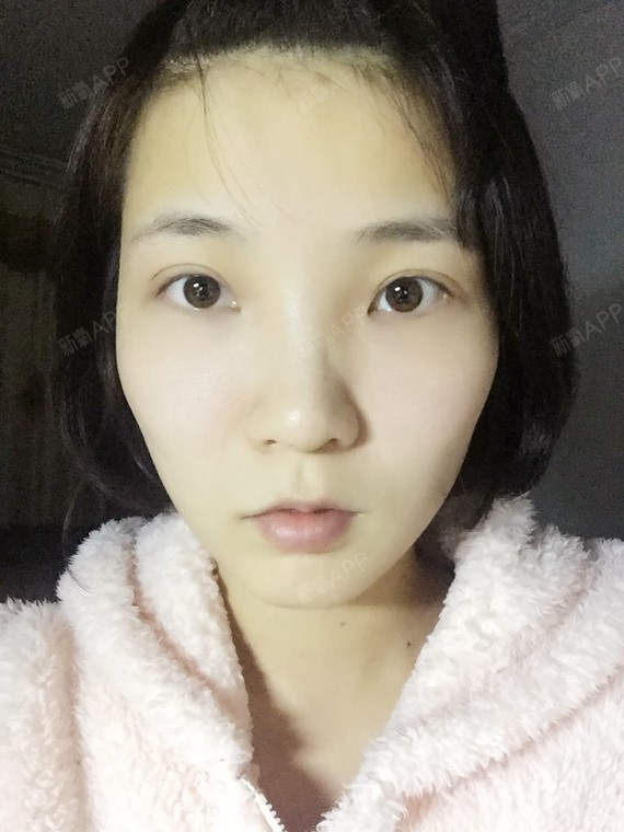 眼角距离比较宽怎么样可以缩短距离