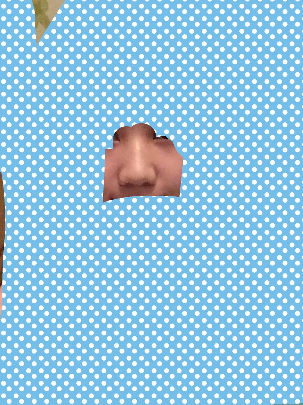 氧气568e27af3252093 | 术后当自强 | 新氧 | 切开鼻孔法鼻翼缩小