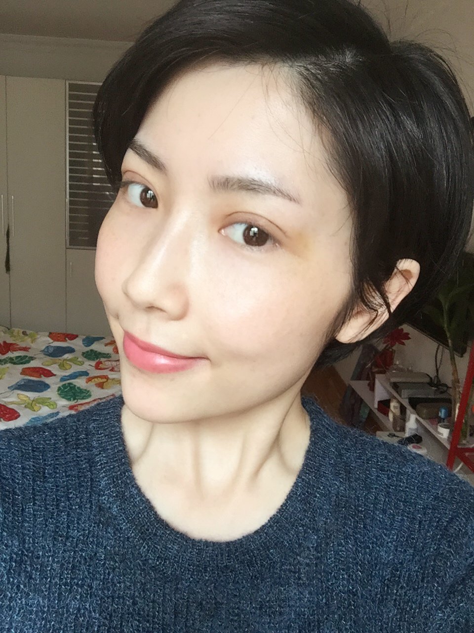 lcy8911223 | 术后当自强 | 眼部整形 | 上海同城 | 全切开双眼皮