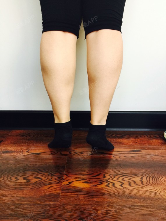 这周去健身的时候又请教练帮忙拍了照片,感觉垫脚时小腿球形肌和外侧