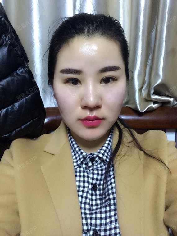 我28岁身高163.体重116斤.自己有开一家小店_圈子-新氧美容整形