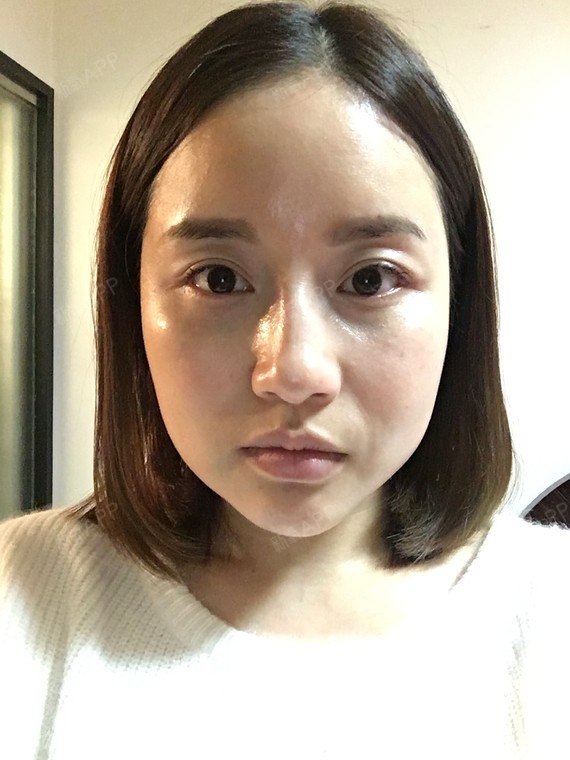 catherine素颜中美丽日记-新氧美容整形