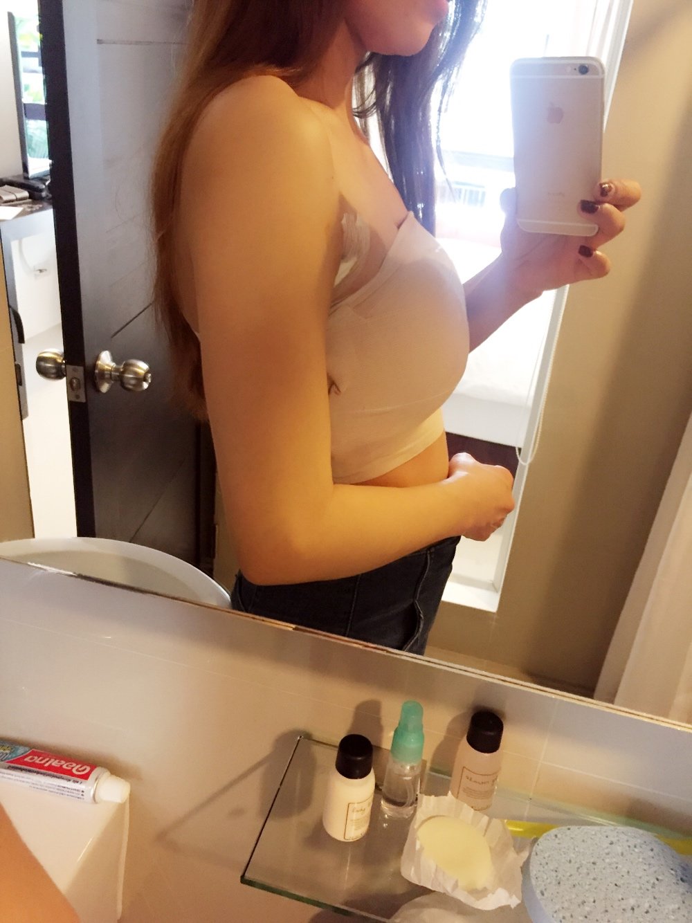 新氧- 小序 | 术后当自强 | 假体隆胸 | 长沙同城 | 胸部整形 | 隆胸