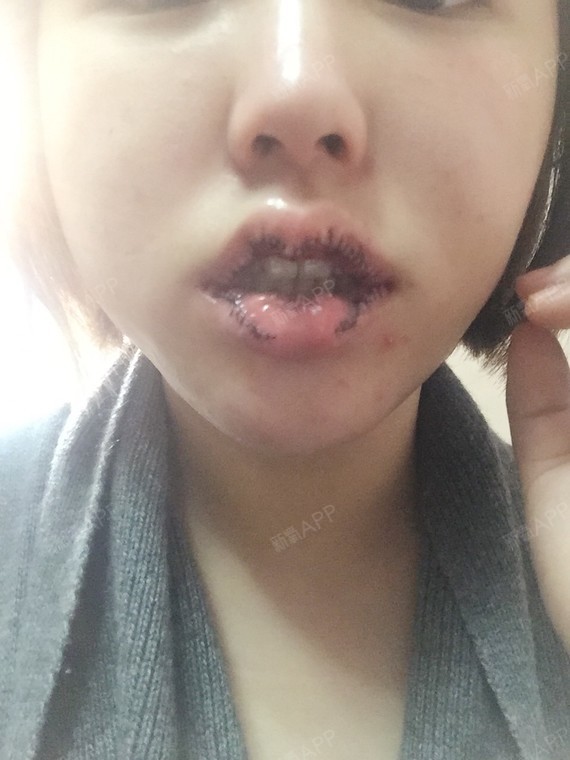 说了这么多优点,还是要客观说说有一点不足之处,就是唇珠这块我