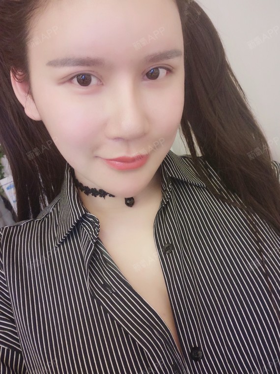 鼻子已经做过两次了,第一次是柳叶型的硅胶,还把鼻子_圈子-新氧美容