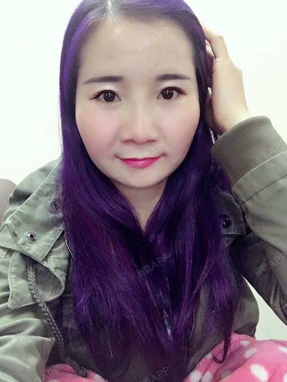 颌面矫正手术是个笼统的说法,具体分为上颌前