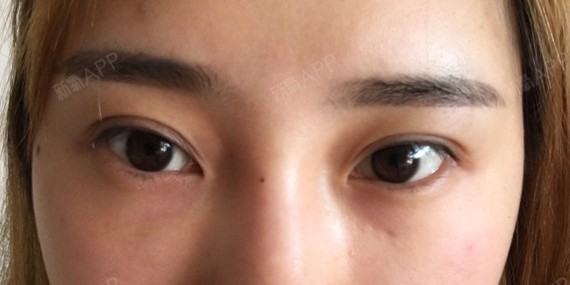 我的眼睛外眼角向上不化妆看起来不友善 好喜欢圆圆的可爱的眼睛 想开