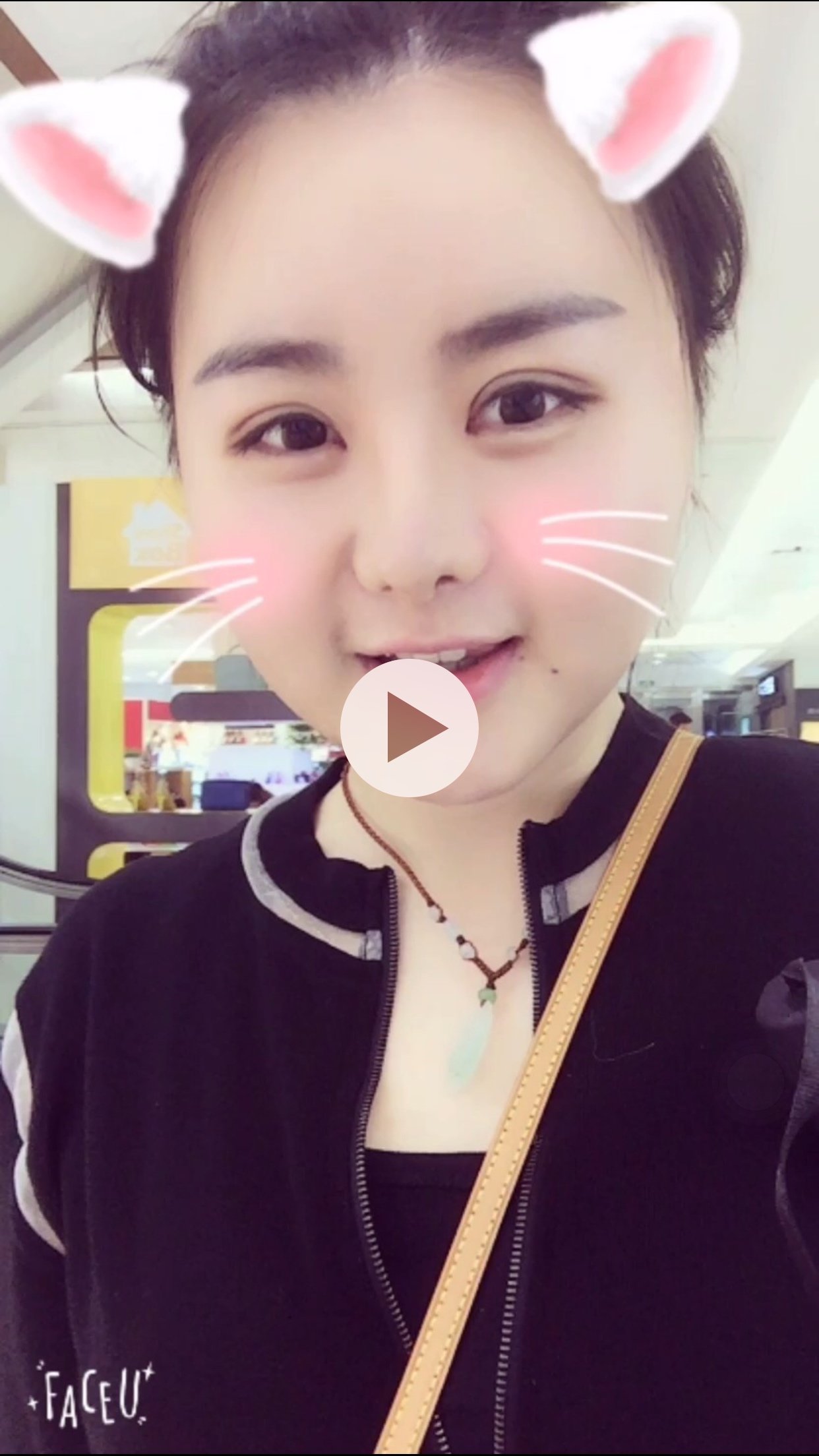 圆滚滚圆v-line瓜子脸手术第35天美丽日记-新氧美容整形