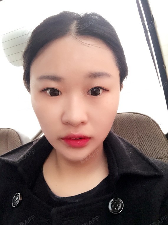 daisy小悦悦第121天美丽日记-新氧美容整形