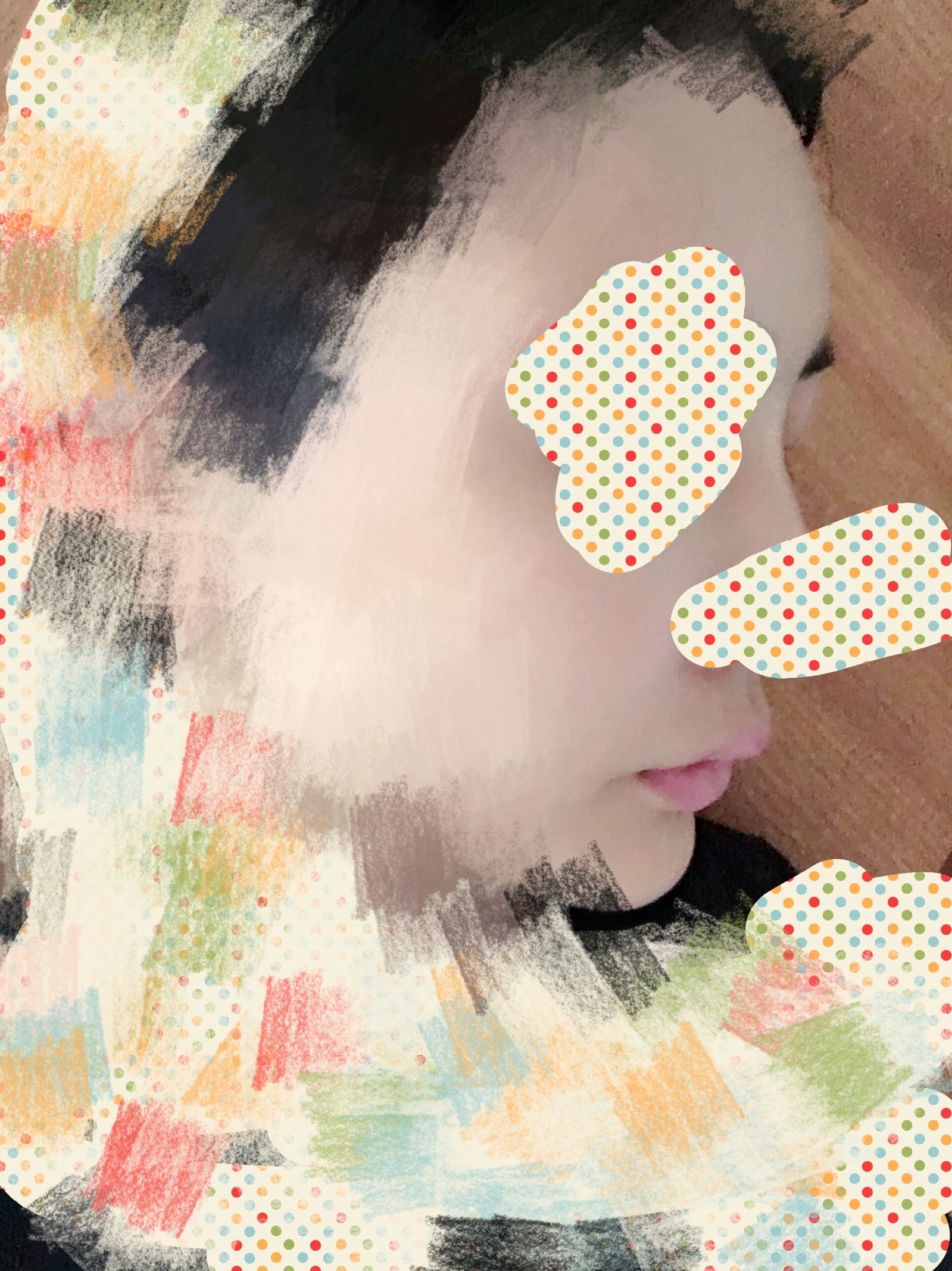 颌面矫正手术是个笼统的说法,具体分为上颌前