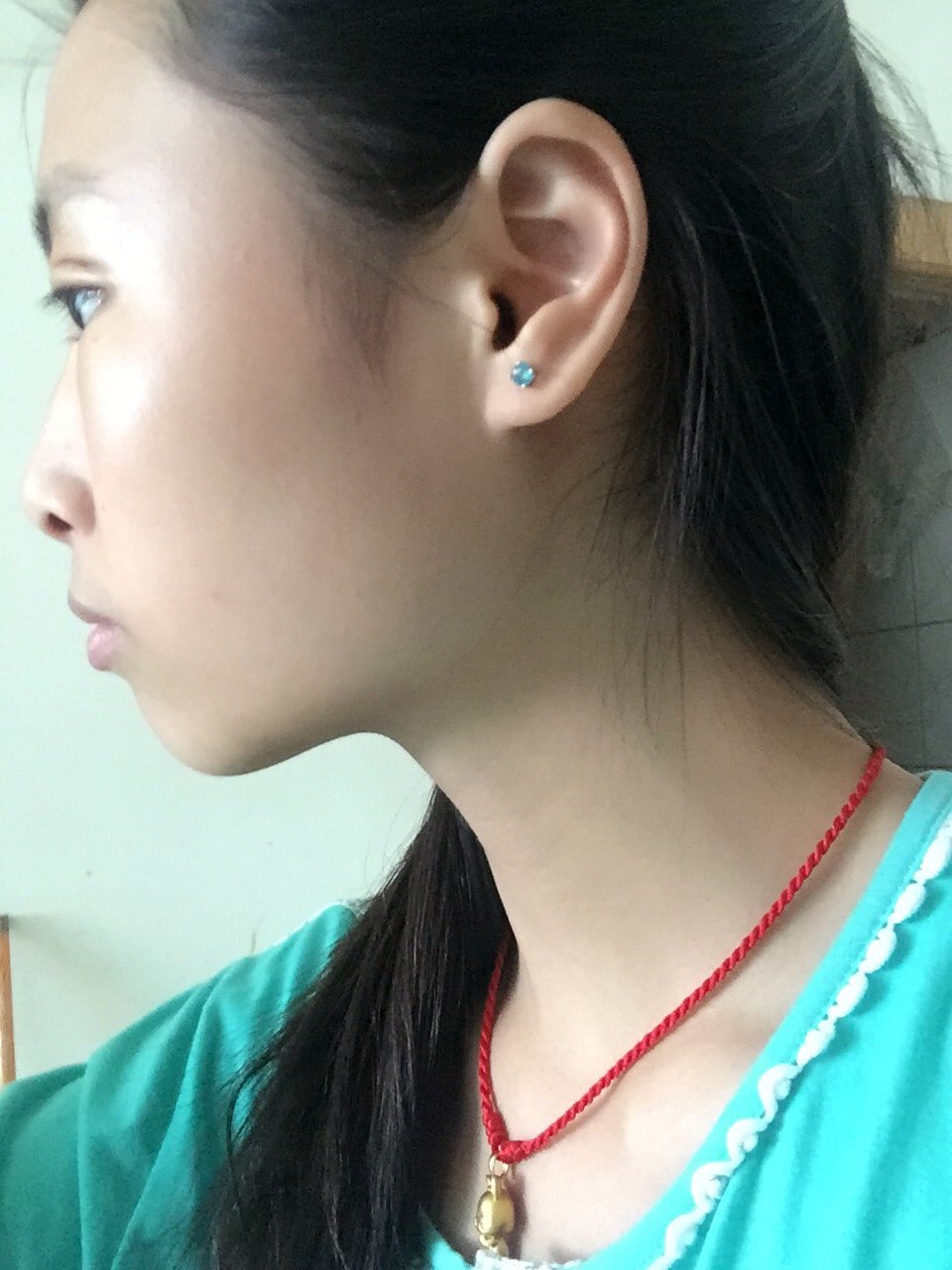 【不是脸大就适合截骨下颌角小于110度才算肥大】所有的姑娘都觉得