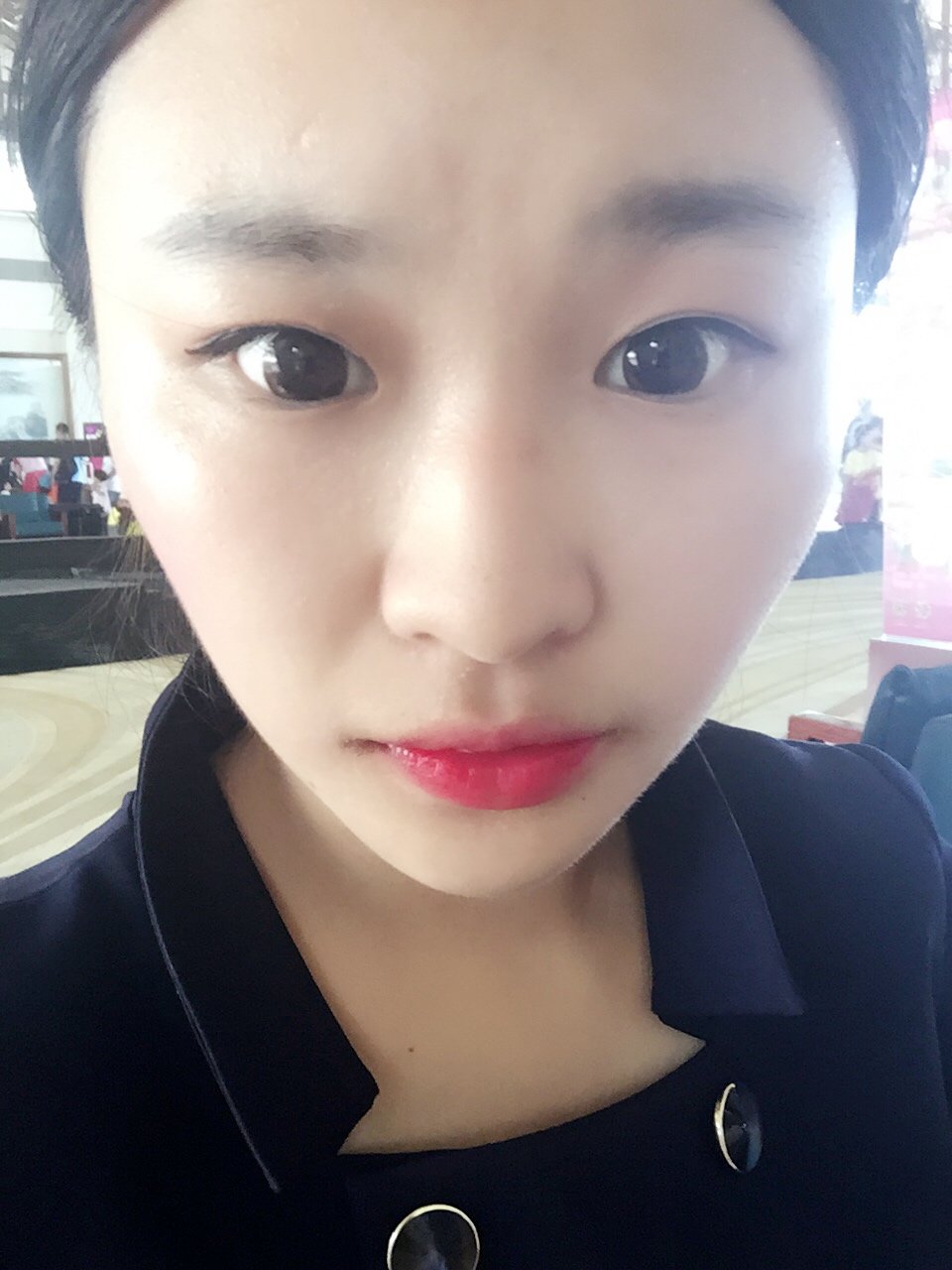 daisy小悦悦第150天美丽日记-新氧美容整形