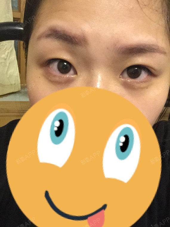 想治治提肌,解决挑眉的问题.
