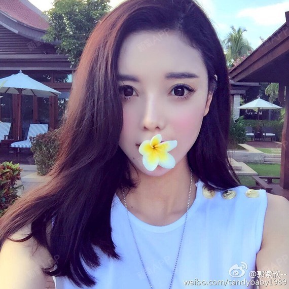 大家觉得哪种假体最自然最不容易产生问题呢 sebbin还