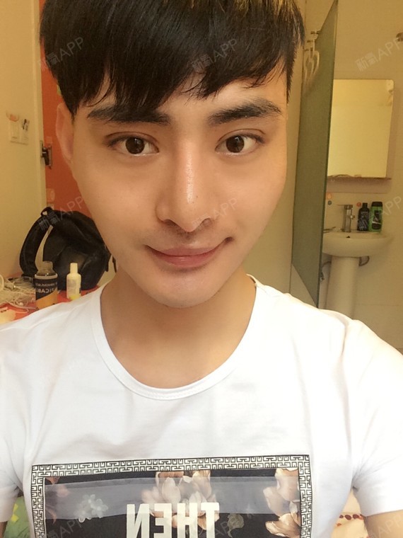 今天左眼一下消肿了好多,感觉线条出来了,好看了很多