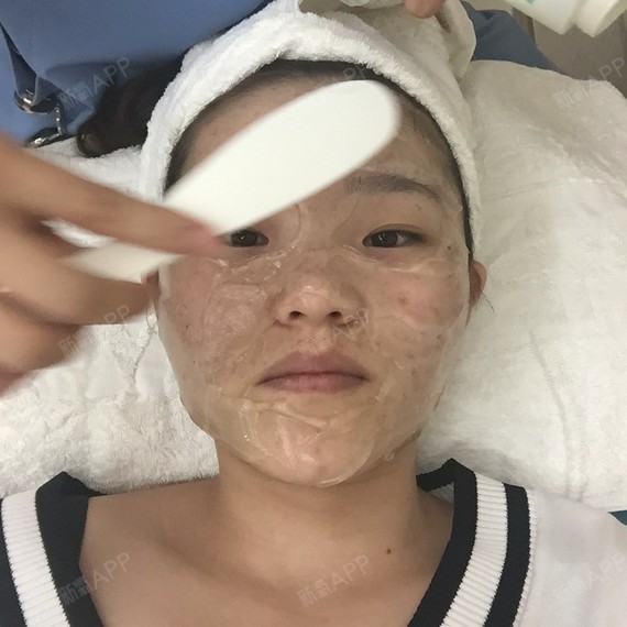 术后第7天