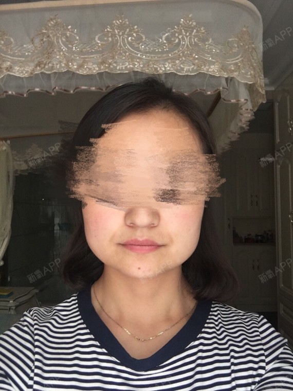 请潘医生看看我可以做下颚角吗