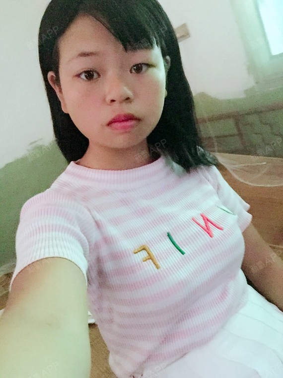 脸太圆了,侧脸肉挺多的,下巴短显得嘴凸