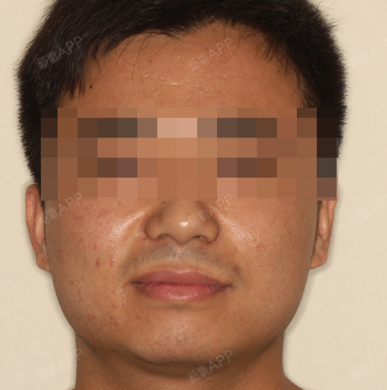 口腔内部高清晰图片