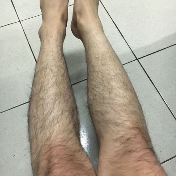 因为我自己是学舞蹈的,然后每次跳现代舞的,每次跳舞的时候,腿毛都会