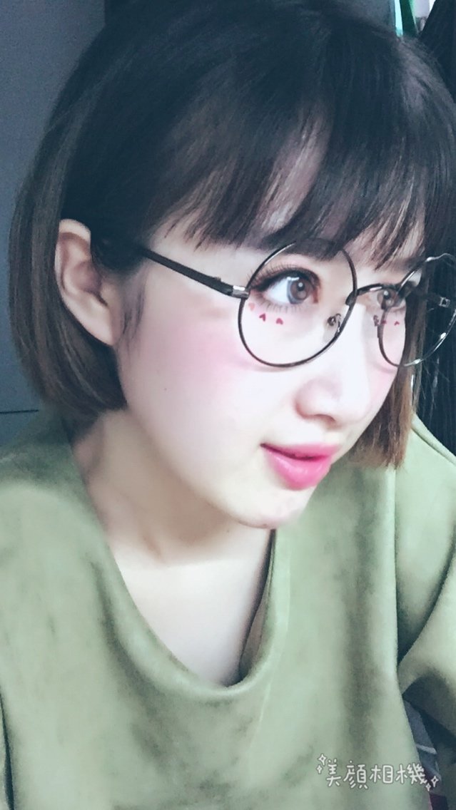 内切去眼袋怎么样_恢复过程_效果如何_Termi