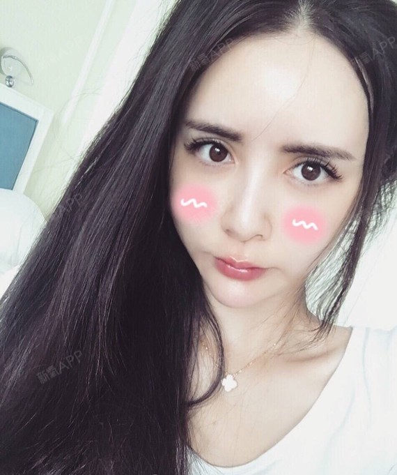 求韩国哪里修复双眼皮比较好的医院医生,想修复的比较_圈子-新氧美容