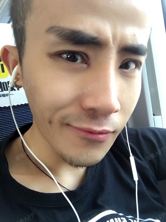 的是太兴奋了,想到拆完线,清清爽爽的眼睛,可以好好洗脸,我就觉得开心