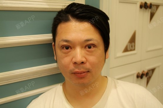 帅的一个男生现在变成大叔了为了对自己和客户负责我选择了做双四角眼