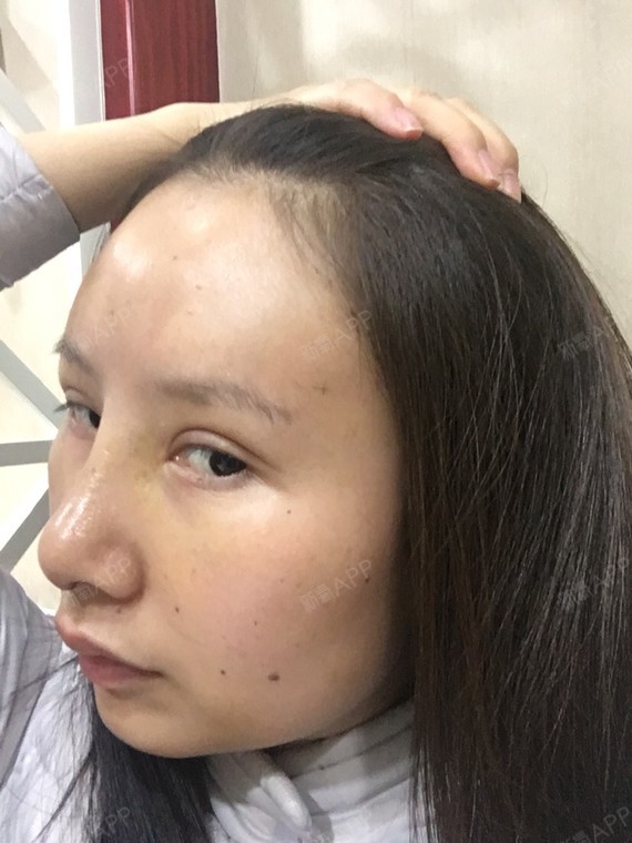 今天填充后十天啦我这吸收的太快了好桑心每天还吃那么多肉肉养着吸收