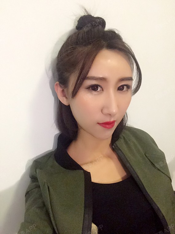 以前额头是一个斜坡似的,现在饱满多了,自拍角度也可_圈子-新氧美容