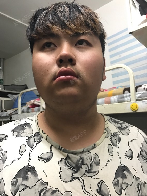 鼻子很挺很有型,哪个角度看都是完美perfect哈哈哈 我果然是胖子界