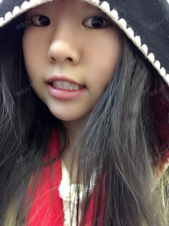 术后第0天
