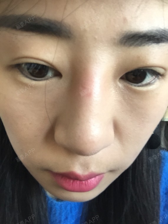 去过_圈子-新氧美容整形