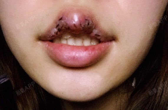 我真的觉得唇珠好翘好圆呀…!