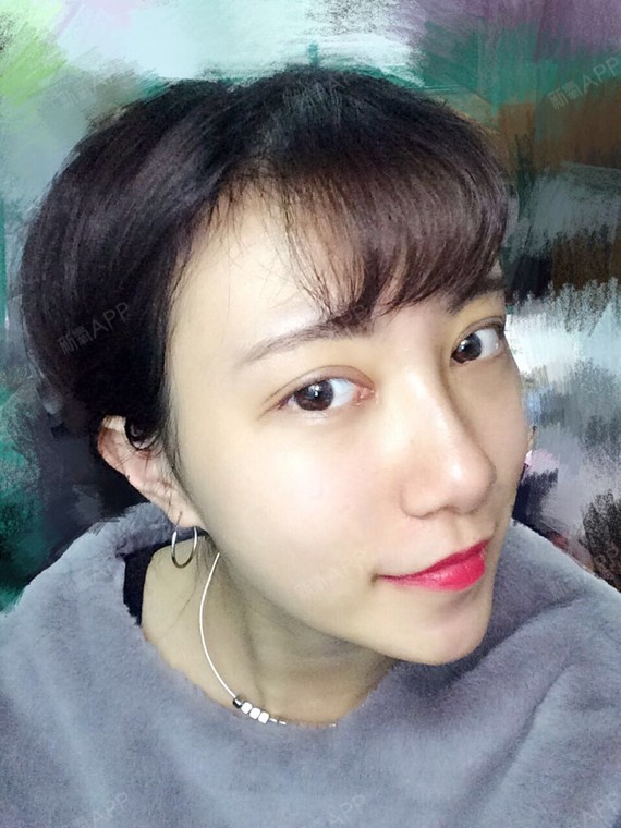 10ml的暴走萝莉开内眼角第13天美丽日记