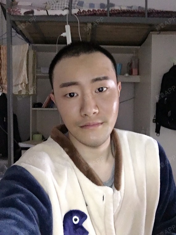 氧气nsfz816b6自体脂肪丰苹果肌第3天美丽日记