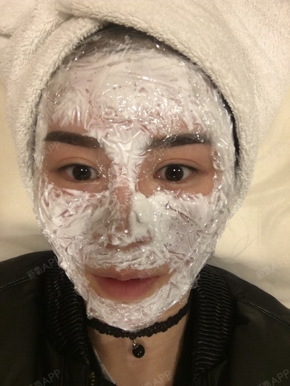 北京黄金微针好不好_效果图_林筱筱1黄金微针术后第天_新氧美容整形