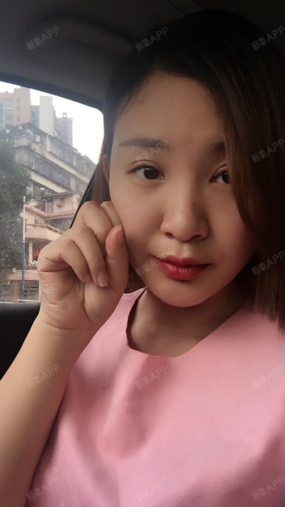 这两天眼睛像被鬼打青了一样!绿绿的,昨天嘚瑟得_圈子-新氧美容整形