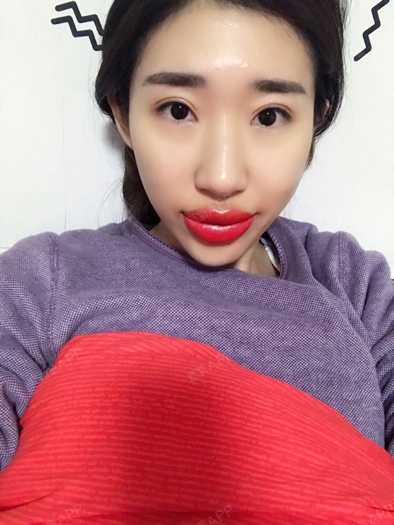 就不应该在大姨妈最凶的一天来做纹唇,直接肿成梁