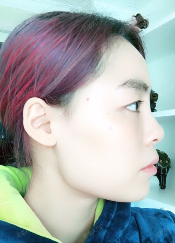 下颌角宽大方脸,牙齿凸出