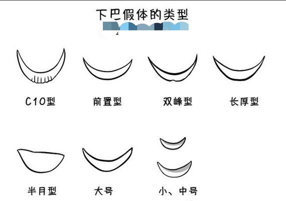 很多人都问,假体下巴的假体类型,这里简单总结下了下.