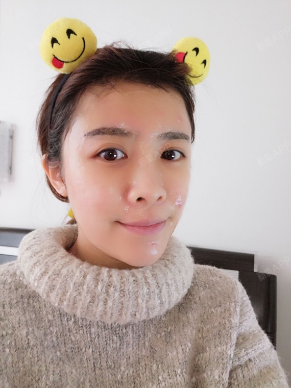 自体脂肪面部填充