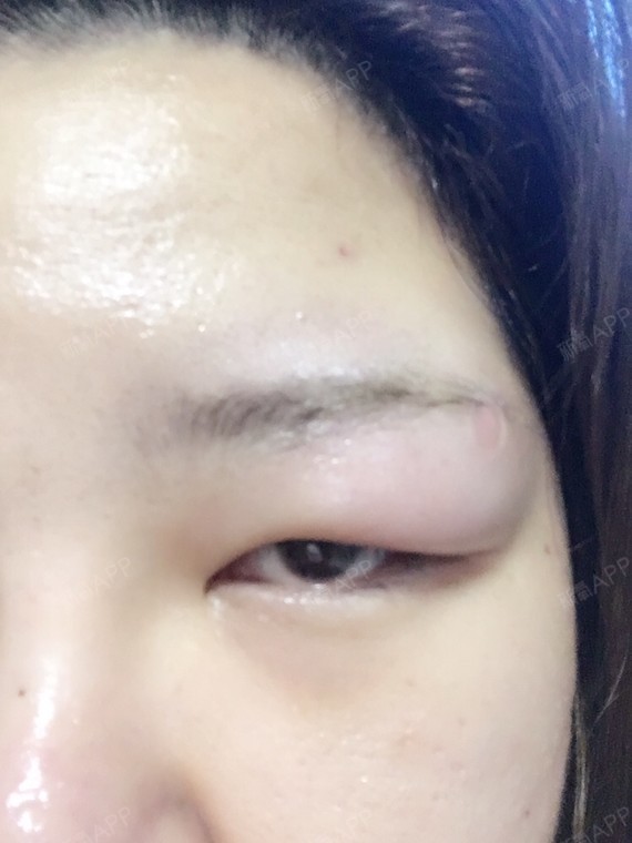 这张是我正常时的照片 我本来十几年前小时候打过眉钉,所以