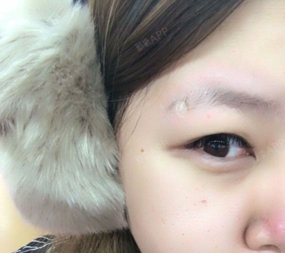 这张是我正常时的照片 我本来十几年前小时候打过眉钉,所以