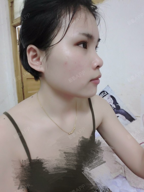 新氧女孩
