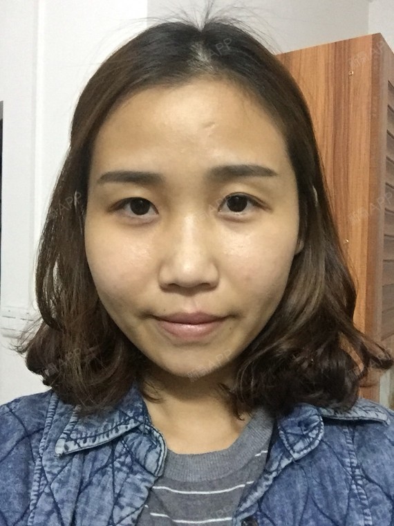 从小到大最不满意的就是自己的鼻子